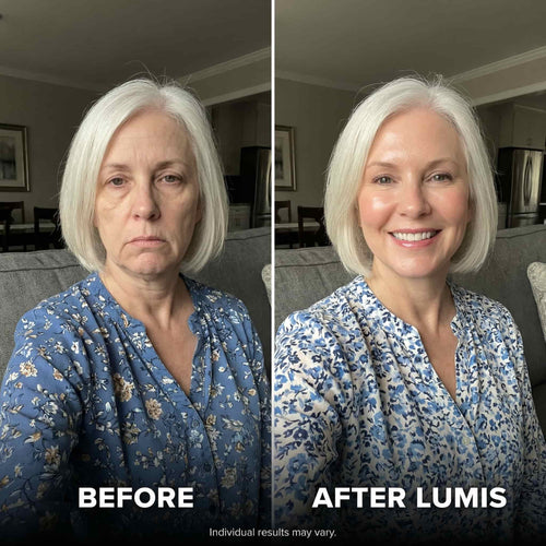 LUMIS Skin Rebuild Complex
