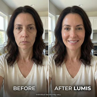 LUMIS Skin Rebuild Complex