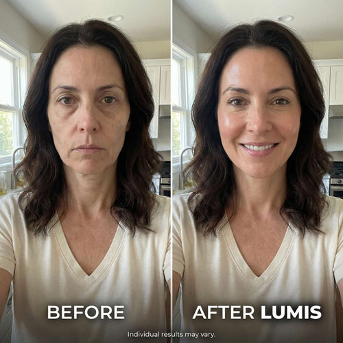 LUMIS Skin Rebuild Complex