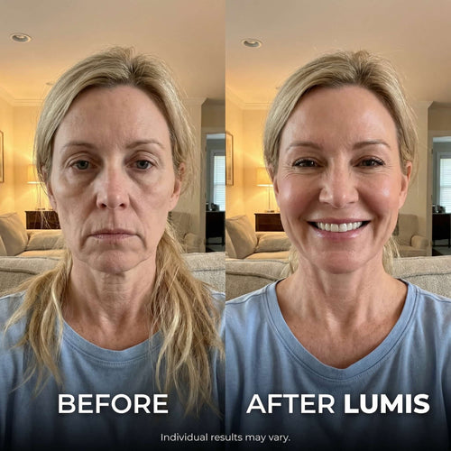 LUMIS Skin Rebuild Complex