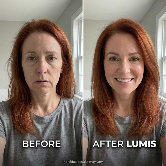 LUMIS Skin Rebuild Complex