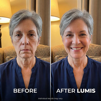 LUMIS Skin Rebuild Complex